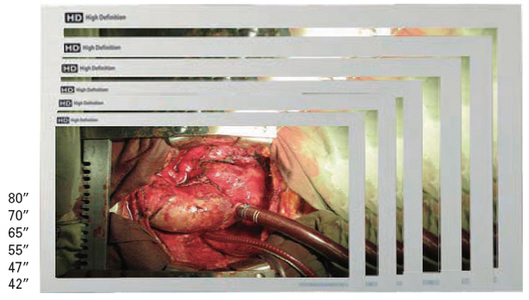 Monitoare sali de operatie KOSTEC