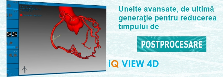 Sistem PACS fiabil si ieftin