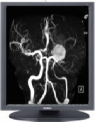 Monitor monochrome TOTOKU MS 25i2